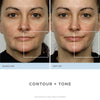 Advanced Facial Toning Kit, Trinity Facial Trainer Device