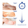 Aliceva One Step Foot Peel Mask, Simple Foot Peeling Mask, Exfoliating Calluses