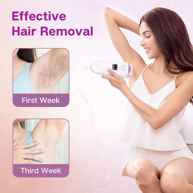 IPL Hair Removal for Women and Men