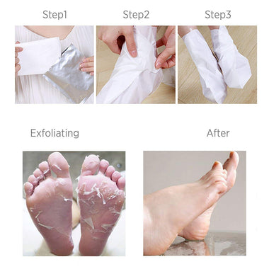 Peeling Away Calluses and Dead Skin Cells Mask