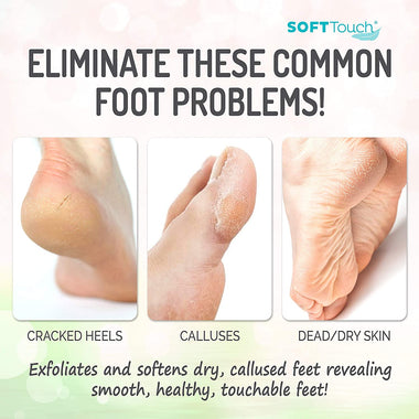 Natural Foot Care Exfoliating Treatment Repairs Cracked Heels
