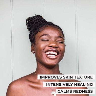 African Black Soap Acne Problematic Skin Bar Organic